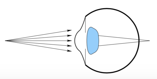 A relaxed eyeball with light coming from a closer object