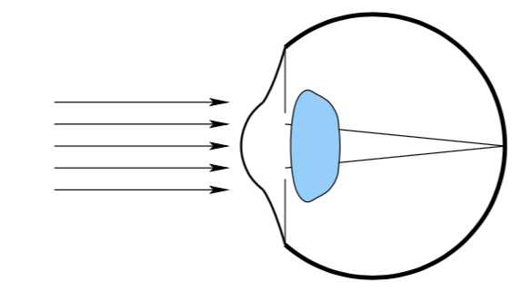 A relaxed eyeball with parallel light rays hitting it